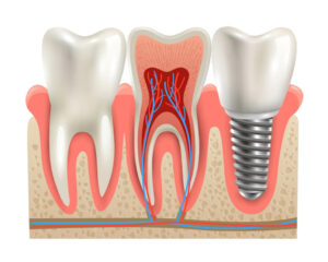 סדרת טיפולי השיניים המורכבים ביותר