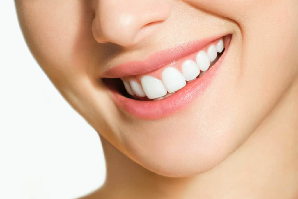 אישה מחייכת אחרי יישור שיניים שקוף